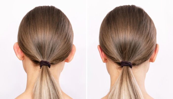 Kulak Ameliyatı kapak görseli