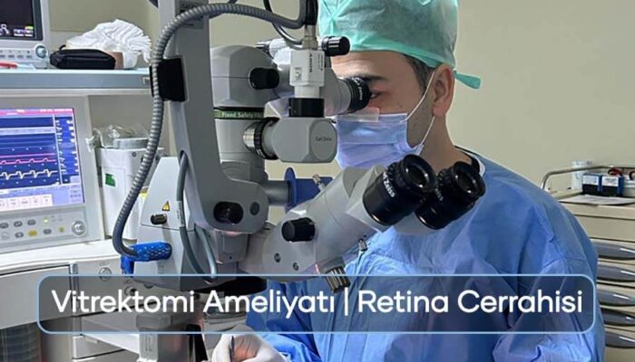 Göz Ameliyatı kapak görseli