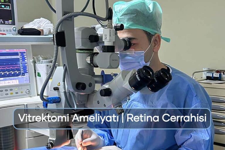 Göz Ameliyatı oyna
